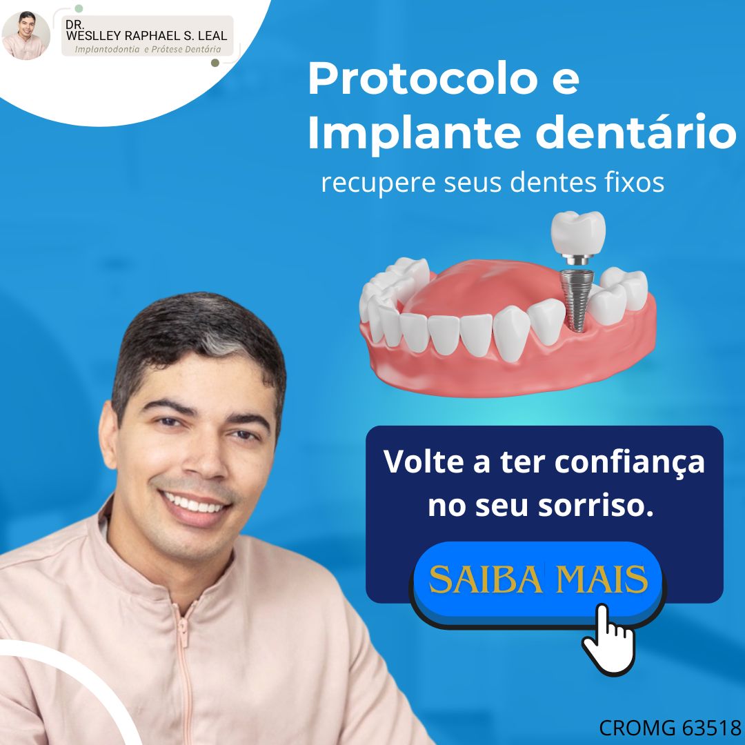 Implantes dentrios 