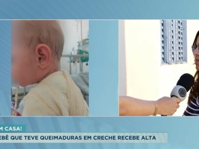 Bebê que teve queimaduras em creche de Patos de Minas, recebe alta